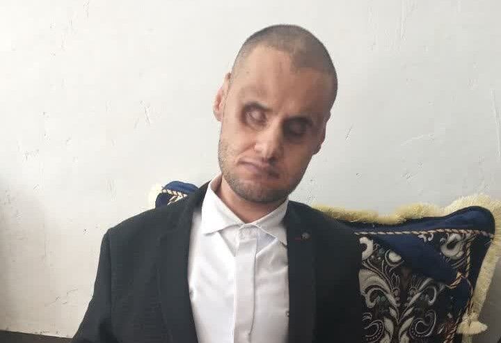 طلوع آیههای نور از سیاهی چشمهای یک روشندل