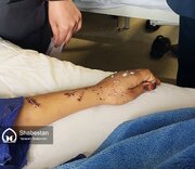 مجروحیت بیش از ۶۰ دانش‌آموز در حادثه تروریستی کرمان