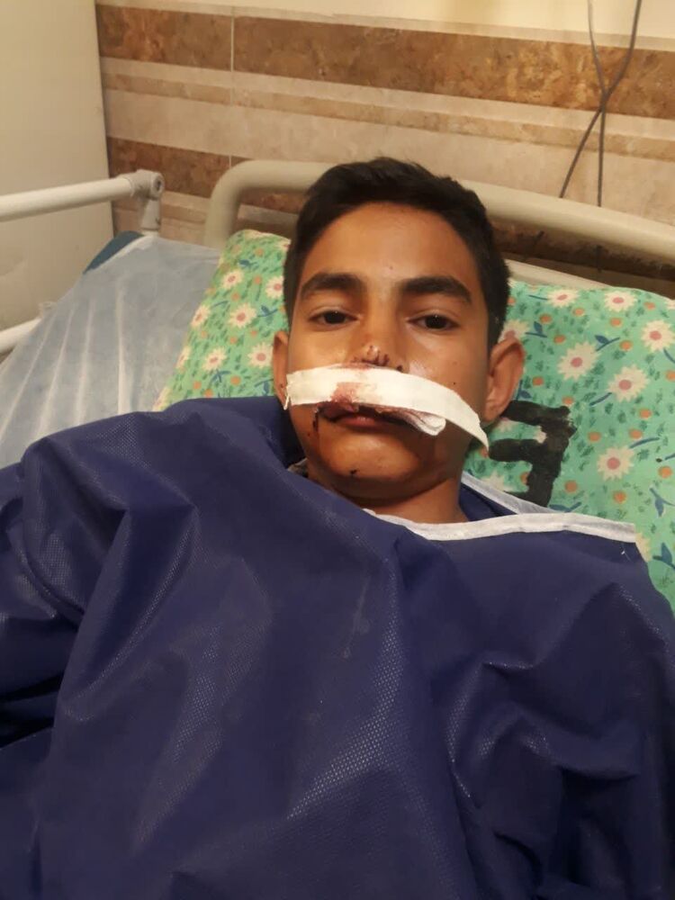 روایتی از مجروح 13 ساله حادثه تروریستی گلزار شهدای کرمان