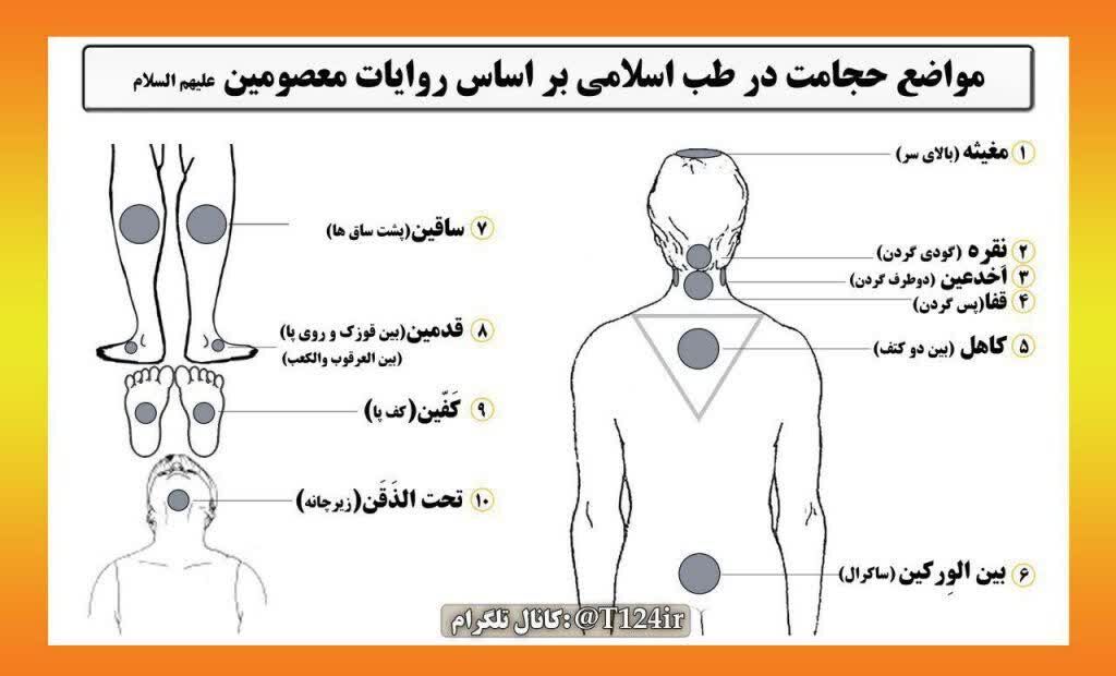 درمان‌های ساده از نگاه طب اسلامی