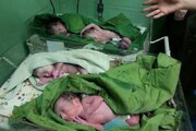 شگفتی در چرداول: تولد چهارقلوها در اولین زایمان مادر ۳۰ ساله