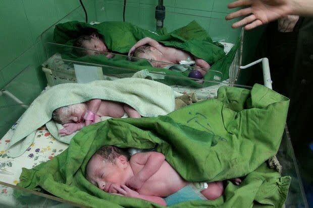 شگفتی در چرداول: تولد چهارقلوها در اولین زایمان مادر ۳۰ ساله