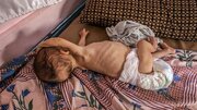 «مرگ تدریجی» بیش از ۴۰ هزار نوزاد زیر یک سال در غزه