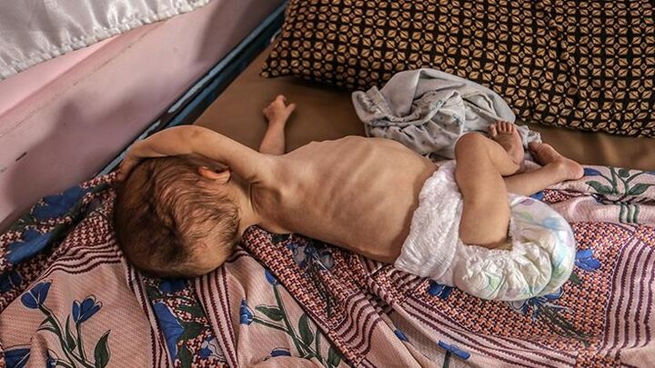 «مرگ تدریجی» بیش از ۴۰ هزار نوزاد زیر یک سال در غزه