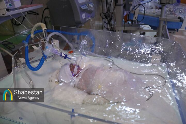 تولد پنج‌قلوهای کرمانی از یک مادر اواخر دهه هفتادی