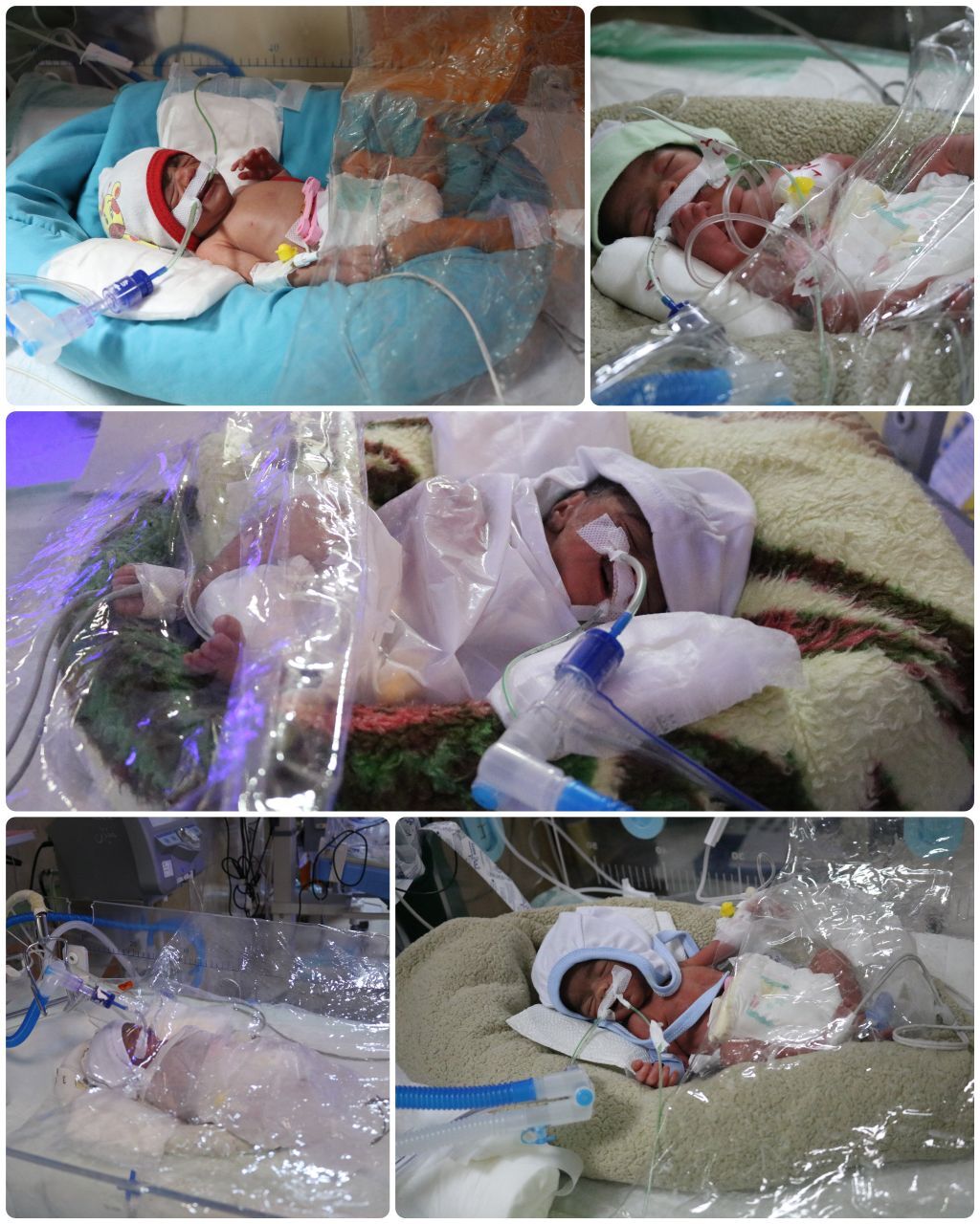 تولد پنج‌قلوهای کرمانی از یک مادر اواخر دهه هفتادی