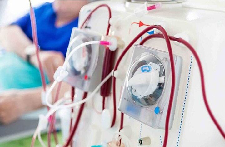 افزایش ۸۰ دستگاه دیالیز در مراکز درمانی هرمزگان با مشارکت وزارت بهداشت و استانداری