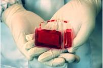 ۷۵۰ نمونه خون بند ناف در خراسان جنوبی ذخیره شد