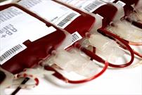 روزهای تاسوعا و عاشورا پایگاه انتقال خون جهرم فعال است