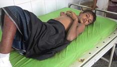 نزدیک به ۴ هزار شهید و مجروح بر اثر بمب های خوشه ای از آغاز تجاوز به یمن