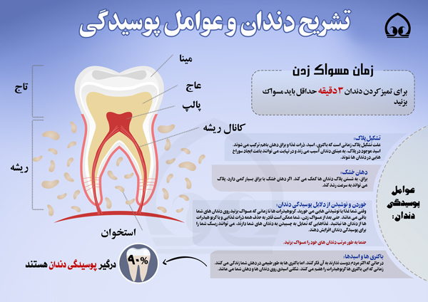 اینفوگرافی/تشریح دندان و عوامل پوسیدگی آن  