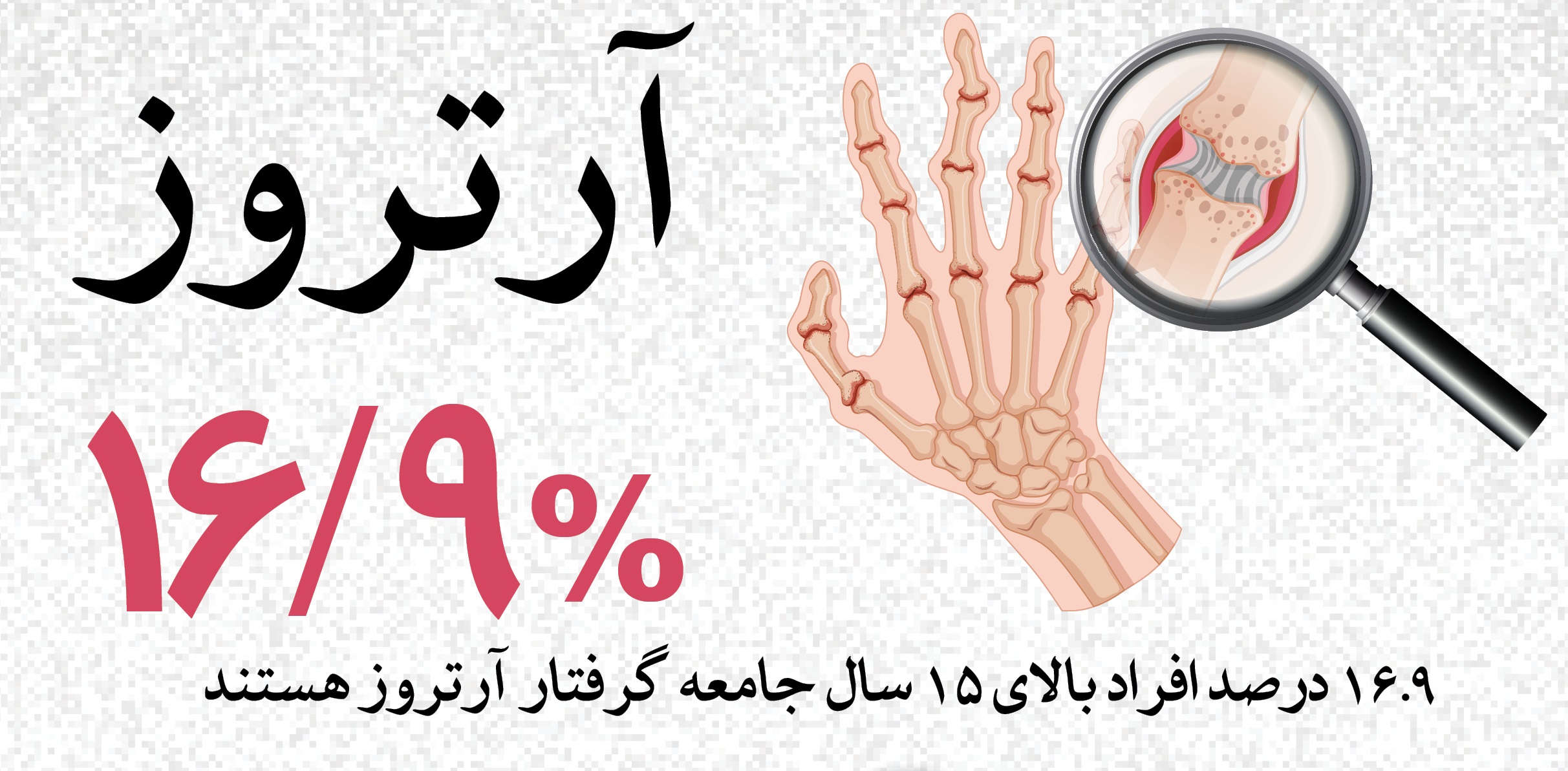 اینفوگرافی/ آرتروز