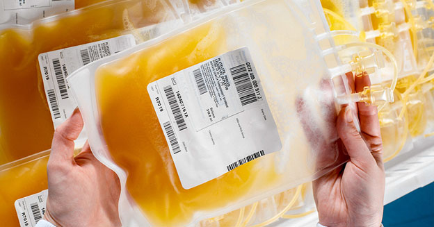اهدای پلاسمای خون برای بهبودیافتگان کرونا هیچ خطری ندارد