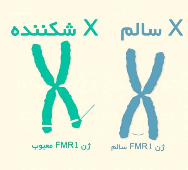 سندرم شکنندگی موجب کاهش ظرفیت عملکردی و ذخایر فیزیولوژیک افراد سالمند می‌شود