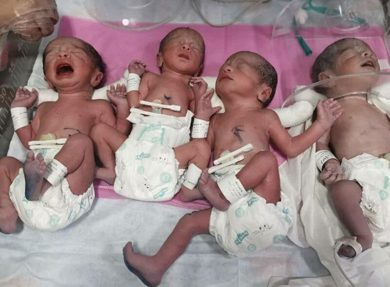 تولد نوزدان چهارقلو برای دومین بار در سال جاری در بیمارستان کمالی کرج