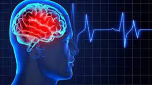 کد ۷۲۴ برای درمان بیماران سکته مغزی فعال می شود