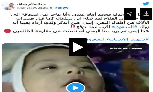 آل سعود این گونه کودکان یمن را به قتل می رساند